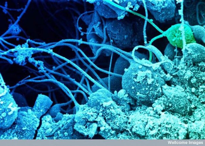 Spermatozoen entwickeln sich in den Hoden - Gemeinsame Dinge unter dem Mikroskop: Was verstecken sie? Сперматозоиды развиваются в семенниках - Обычные вещи под микроскопом