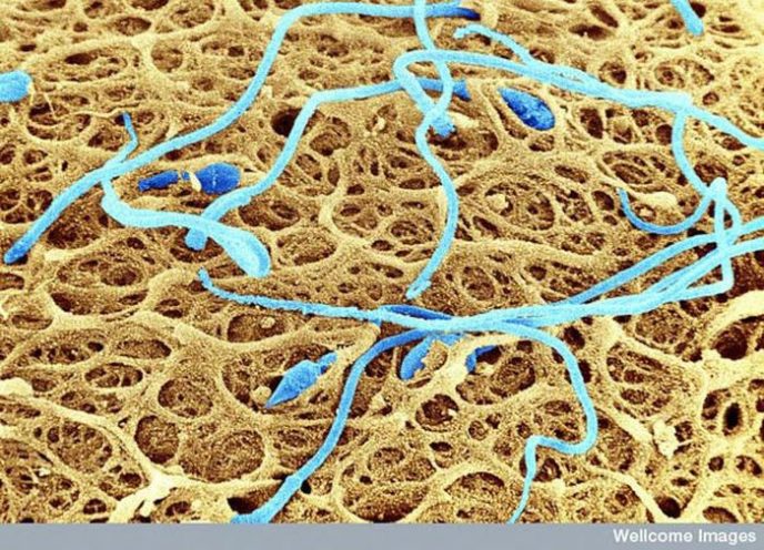 Spermatozoen auf der Oberfläche eines Eies - Gemeinsame Dinge unter dem Mikroskop: Was verstecken sie? Сперматозоиды на поверхности яйцеклетки - Обычные вещи под микроскопом