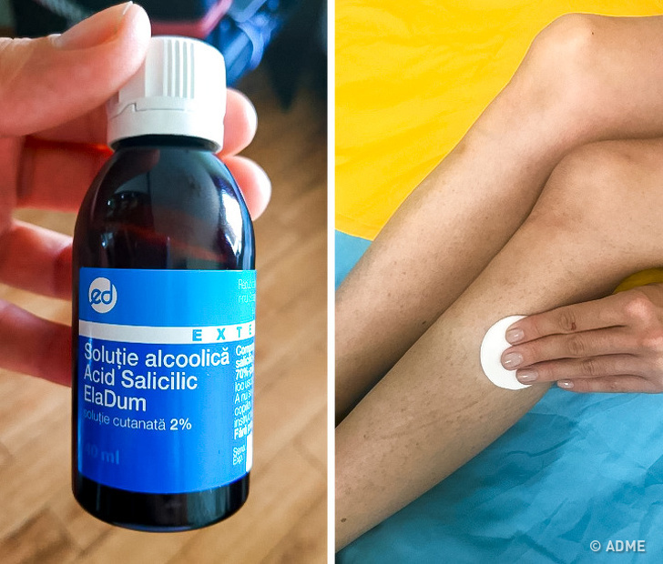 Salicylsäure - Günstige Medikamente aus der Apotheke, die genauso gut wirken wie teure Kosmetika Салициловая кислота - Бюджетные средства из аптеки, не хуже дорогой косметики