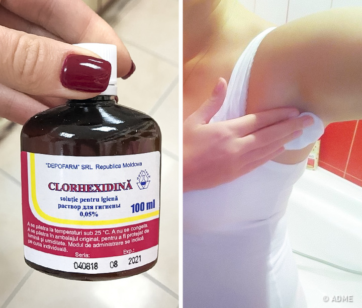 Chlorhexidin - Günstige Medikamente aus der Apotheke, die genauso gut wirken wie teure Kosmetika Хлоргексидин - Бюджетные средства из аптеки, не хуже дорогой косметики