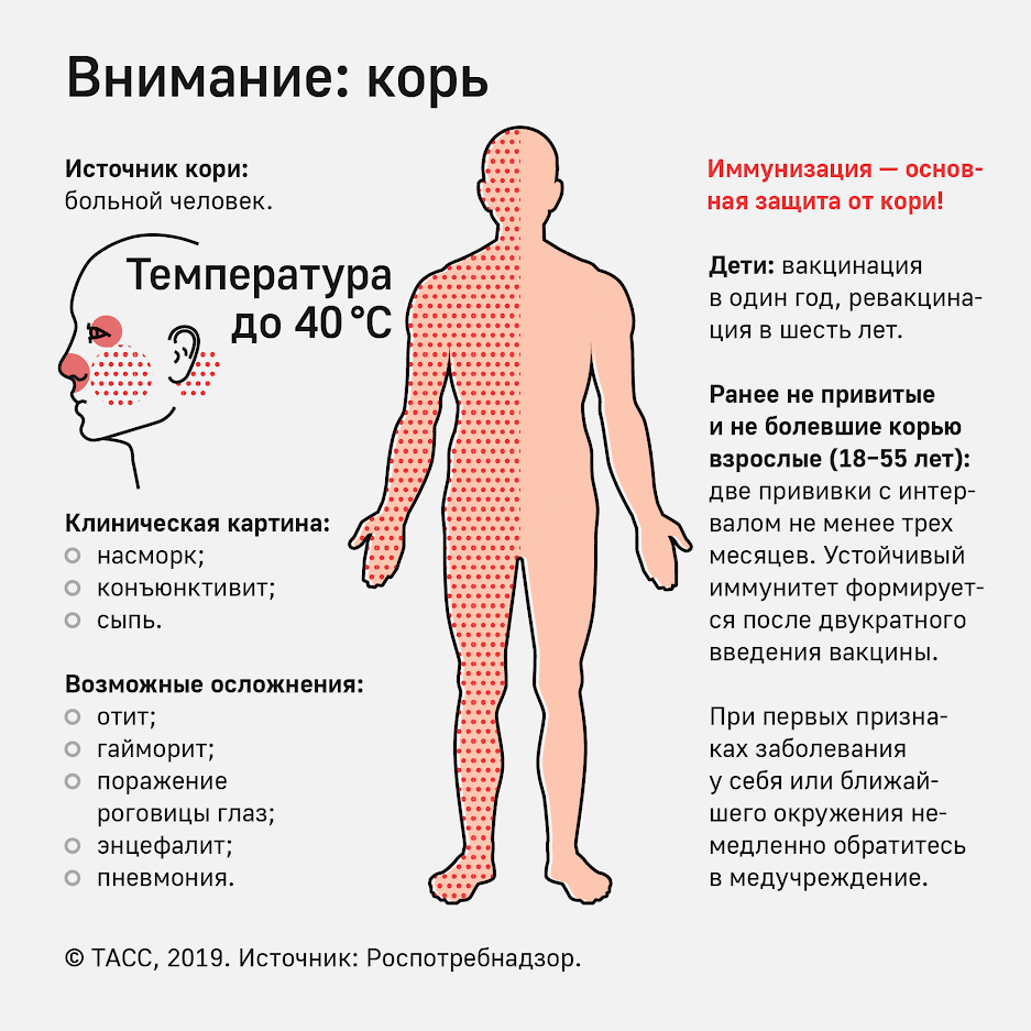 Was verursacht Windpocken bei Masern und Scharlach bei Röteln? Корь, скарлатина, краснуха