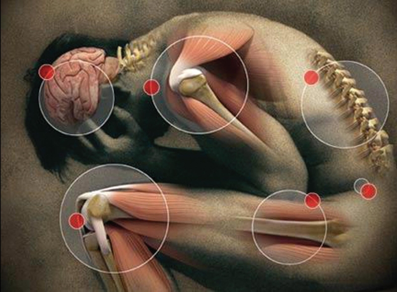 Neuropathischer Schmerz Нейропатическая боль