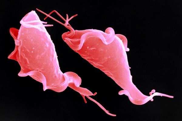 Trichomonas. Heimtückische parasitäre Infektion, die die Bevölkerung verschlang Трихомонада