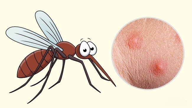 Mosquito - Wie man erkennt, welches Insekt dich gebissen hat Комар - Чей это укус?