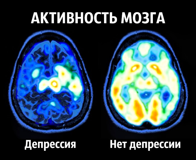 Neurowissenschaften geben Tipps, wie man ein für allemal glücklich wird Как стать счастливым