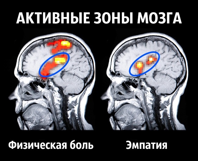 Neurowissenschaften geben Tipps, wie man ein für allemal glücklich wird Как стать счастливым