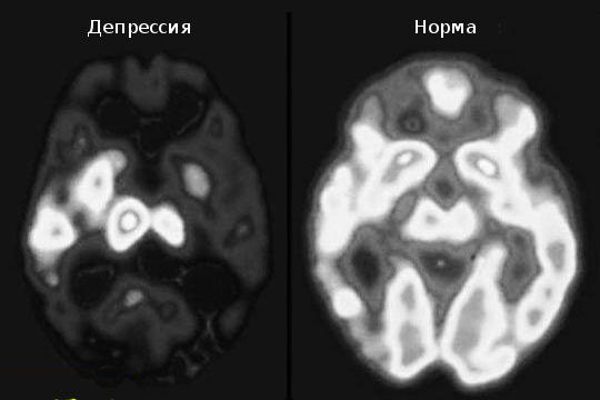 Alles, was die Seele erlebt, macht der Körper sichtbar Что переживает Душа, Тело делает видимым