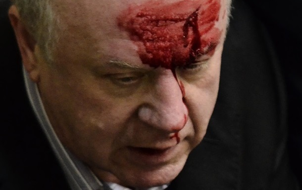 Der ehemalige Sicherheitschef zertrümmerte Akhmetov seine Stirn in die Halle Rada Бывшему шефу безопасности Ахметова разбили лоб в зале Рады