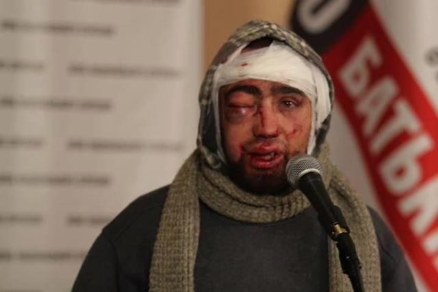 Беркут продолжает пытать задержанных активистов и использует металлические пули. ФОТО