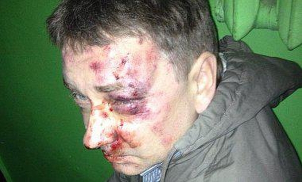 В Сумах неизвестные жестоко избили одного из организаторов местного Майдана, журналиста Положия. ФОТО