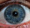 Blue Eye - Arten von Augenfarben