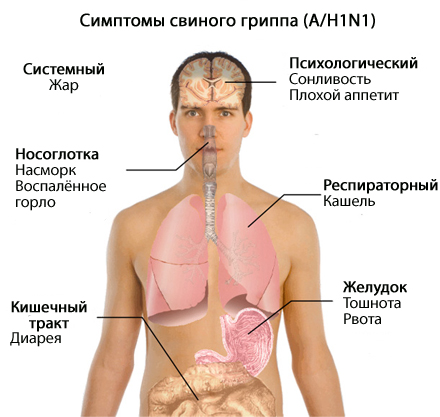 Checkliste für die Influenza Typ A / H1N1