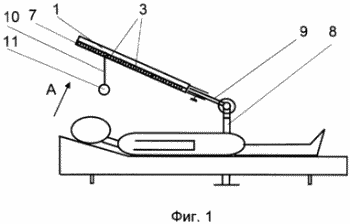 Wege der psycho-emotionalen Zustand RECHTE UND VORRICHTUNG ZU SEINER DURCHFÜHRUNG beeinflussen. Russische Föderation Patent RU2143930